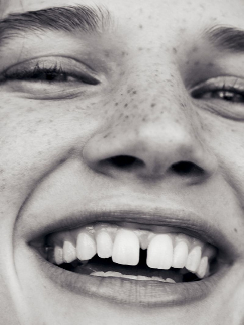 Dents du bonheur + taches de rousseur + regard ptillant = le bon mix